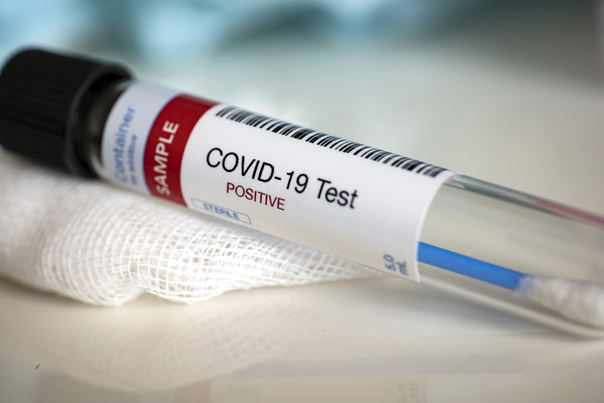A test tube containing a blood sample for COVID-19 testing