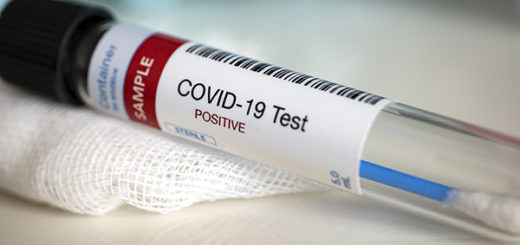 A test tube containing a blood sample for COVID-19 testing